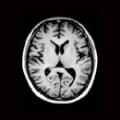 MRI画像.png